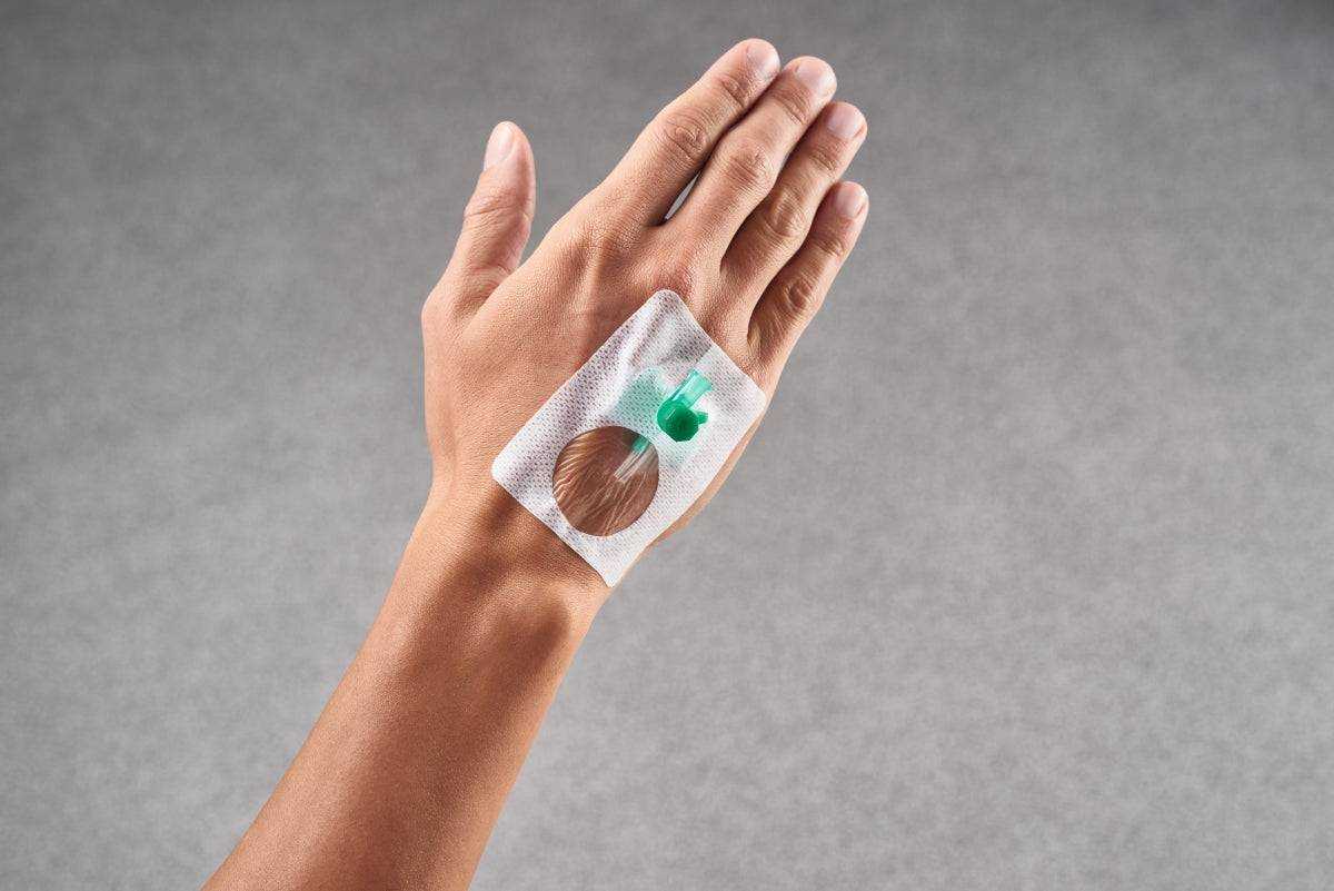 Curafix i.v. Kanülenfixierung steril 6x7,5cm auf Handrücken angebracht, zeigt sichere Fixierung eines peripheren Venenkatheters mit hautfreundlichem Verband.