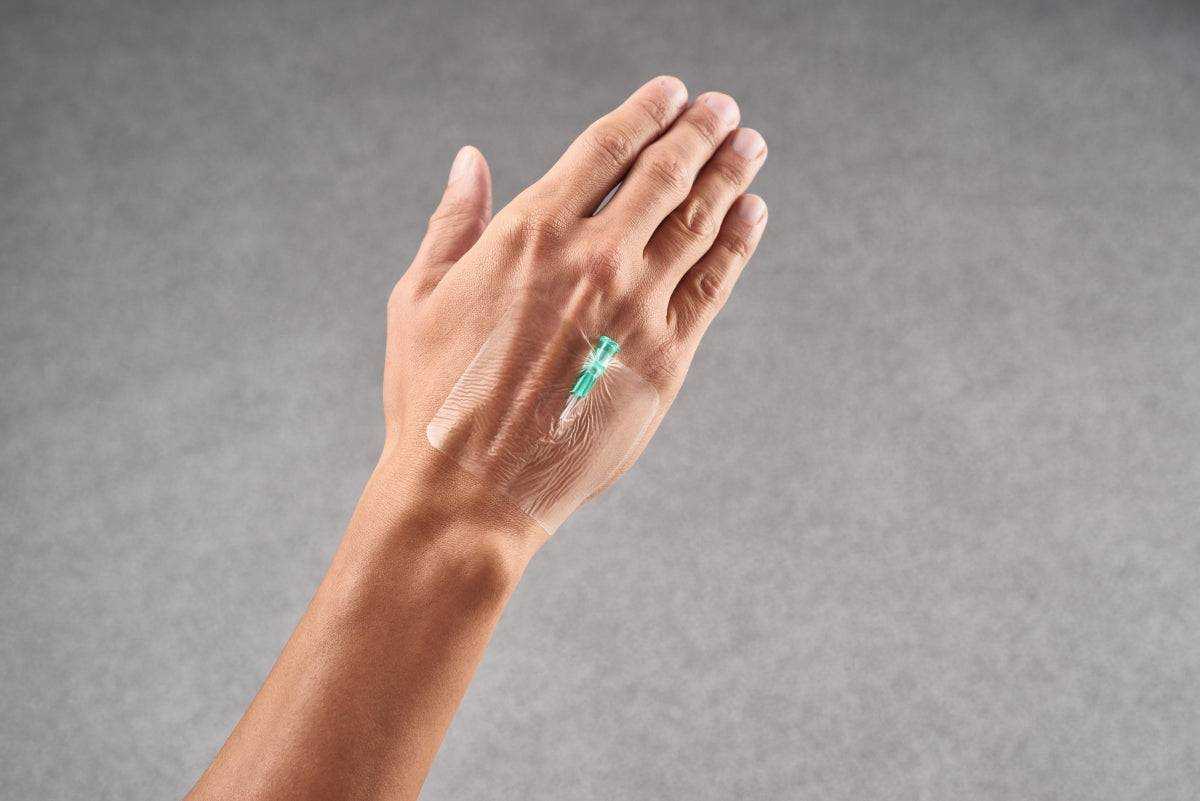 Curafix i.v. Film Kanülenfixierung steril, 6x7cm, 100 Stück - Medasi.shop - PZN - 14212415